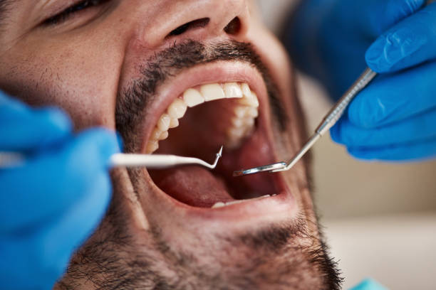 Best Weekend Emergency Dentist in Hephzibah, GA
