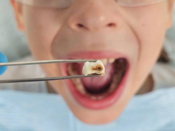 Best Mobile Emergency Dentist in Hephzibah, GA