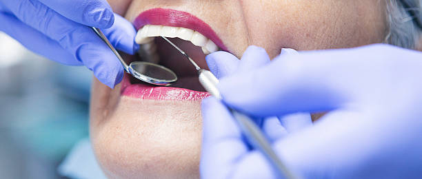 Best Emergency Dentist for Lost Fillings or Crowns in Hephzibah, GA